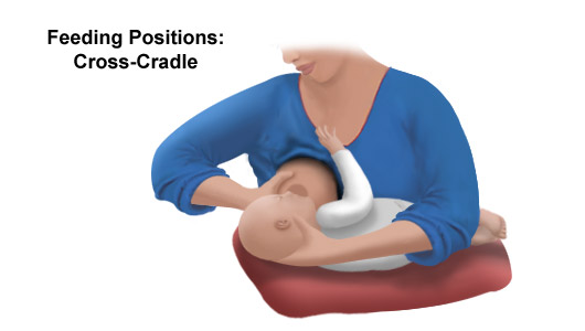 Illustration of breastfeeding, cross-cradle position