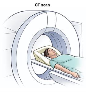 CT scan.